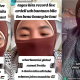Ardell Aryana Dedah Prosedur